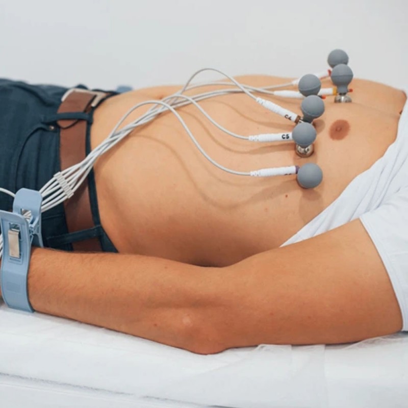 ECG