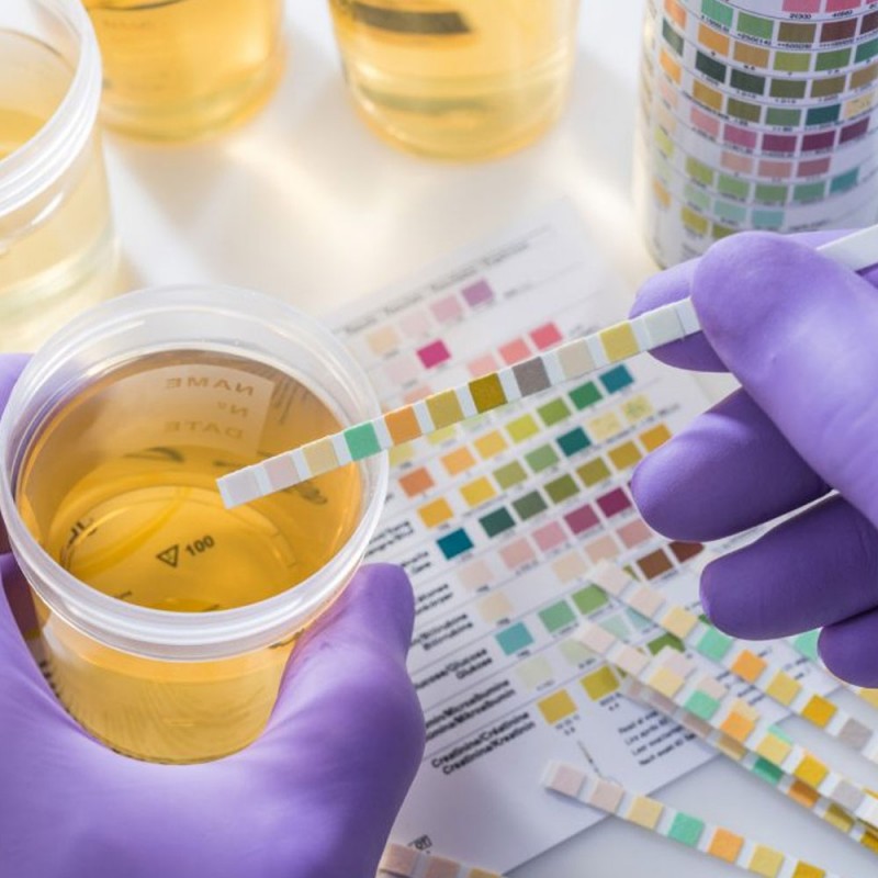 Urine Test