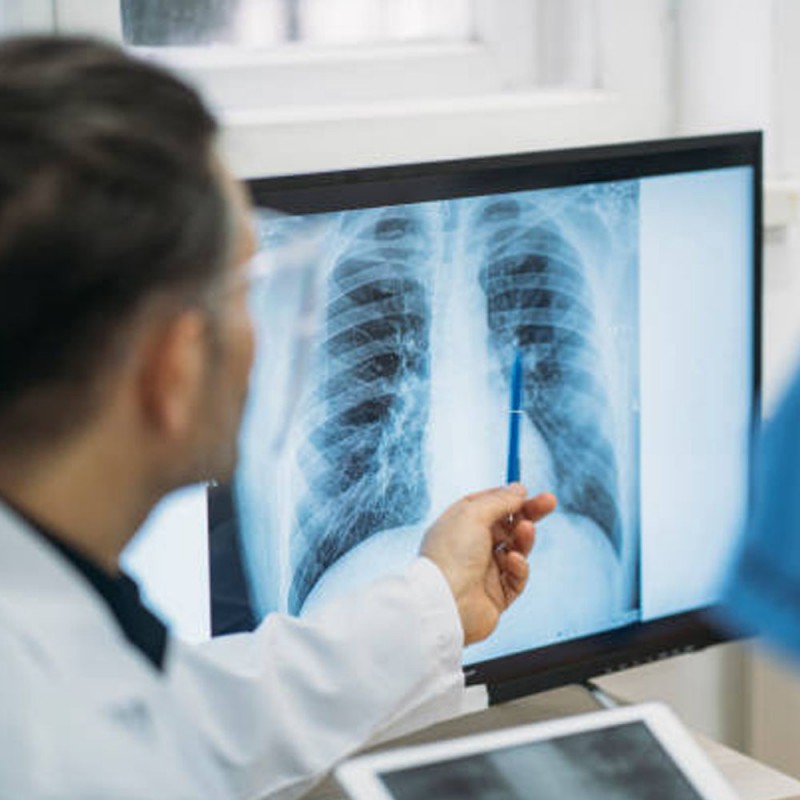 X-Ray